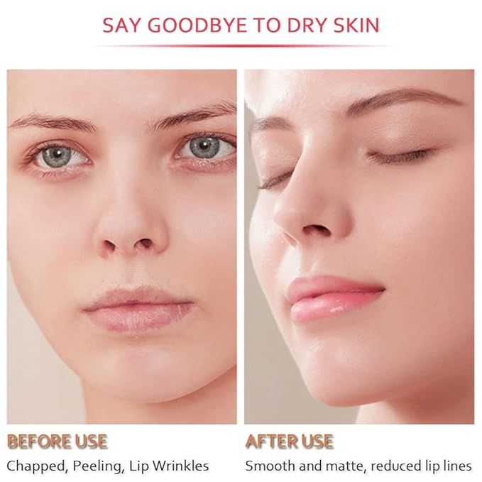 20Pcs Moisturizing Restores Moisture Lip Mask for Dry Lips and Lip Lines Overnight Lip Care, Gel Treatment Plumping Lips Mask (Red)