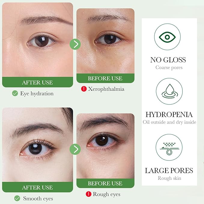 BIOAQUA Centella Asiatica Nourish Repair Eye Cream Soothing Oil Control Anti-Acne 20g / 0.7oz